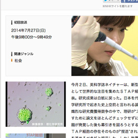 STAP細胞捏造・笹井氏自殺は「NHKと文春のせい」は本当か